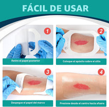 Cargar imagen en el visor de la galería, Vendaje Transparente Impermeable para Heridas