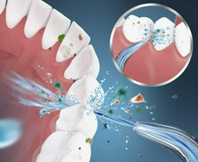 Cargar imagen en el visor de la galería, Irrigador bucal dental inalámbrico resistente al agua y recargable
