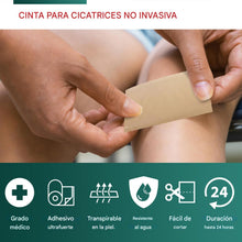 Cargar imagen en el visor de la galería, Láminas de silicona para eliminar cicatrices