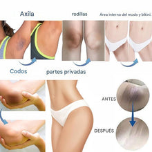 Cargar imagen en el visor de la galería, Crema blanqueadora de piel para el cuerpo y area íntima