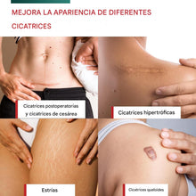 Cargar imagen en el visor de la galería, Láminas de silicona para eliminar cicatrices