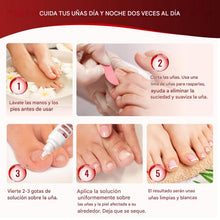 Cargar imagen en el visor de la galería, Tratamiento para Uñas de los Pies, Fungi Nail