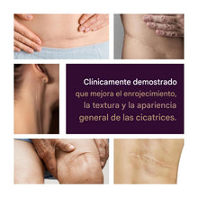 Cargar imagen en el visor de la galería, Gel para cicatrices avanzado Mederma - 1 vez al día