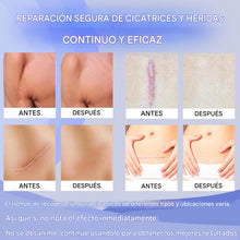 Cargar imagen en el visor de la galería, Hojas de silicona para cicatrices