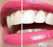 Cargar imagen en el visor de la galería, Kit de 28 tiras de blanqueamiento dental