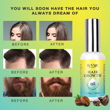 Cargar imagen en el visor de la galería, Biotina Aceite de crecimiento del cabello 1.7 oz