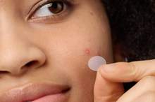 Cargar imagen en el visor de la galería, Parche original para el acné
