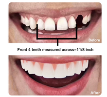 Cargar imagen en el visor de la galería, JARENGO Dientes Falsos Fit Flex 1pk - Tono Natural - Dientes Cosméticos de Chapa Superior
