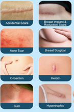 Cargar imagen en el visor de la galería, Gel de cicatriz avanzado, gel de silicona para cicatrices
