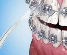 Cargar imagen en el visor de la galería, Irrigador bucal dental inalámbrico resistente al agua y recargable
