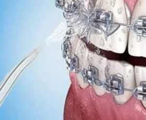 Irrigador bucal dental inalámbrico resistente al agua y recargable