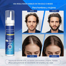 Cargar imagen en el visor de la galería, Espuma tópica de minoxidil al 5%
