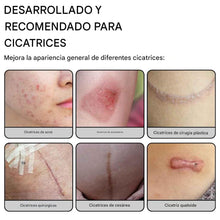 Cargar imagen en el visor de la galería, Hojas de silicona para cicatrices
