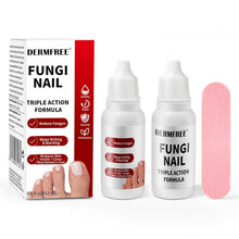 Cargar imagen en el visor de la galería, Tratamiento para Uñas de los Pies, Fungi Nail
