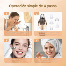 Cargar imagen en el visor de la galería, Extractor profesional de puntos negros
