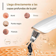 Cargar imagen en el visor de la galería, Extractor profesional de puntos negros

