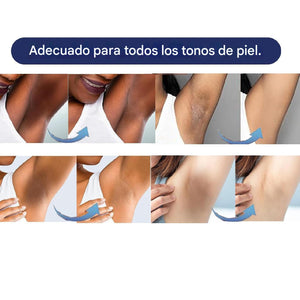 Crema blanqueadora de piel para el cuerpo y area íntima