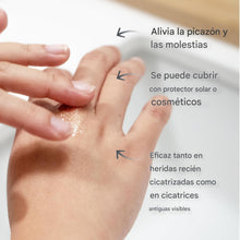 Cargar imagen en el visor de la galería, Gel de silicona para cicatrices
