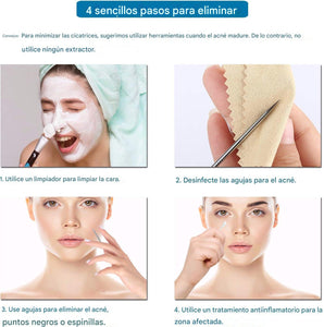 Kit de herramientas para eliminar puntos negros, 9 unidades