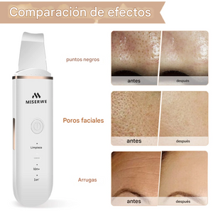 Limpiador de poros, herramienta de elevación de belleza para la cara, con 4 modos