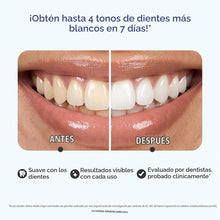 Cargar imagen en el visor de la galería, Kit de tiras blanqueadoras dentales - Tratamiento de 7 días⚡
