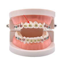 Cargar imagen en el visor de la galería, Lazos de ligadura ortodóntica dental(1008pcs, multicolores NDP40

