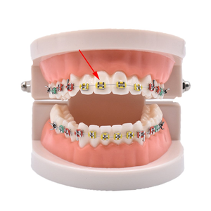 Lazos de ligadura ortodóntica dental(1008pcs, multicolores NDP40